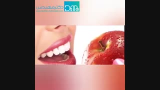 رفع زردی دندان در 2 دقیقه