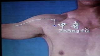 نمونه درس طب سوزنی جلد اول . دکتر ابراهیم مقیمی