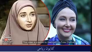 بازیگران زن ایرانی قبل و بعد عمل جراحی