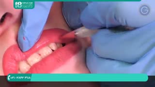 آموزش تاتو موقت لب