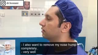 کوچک شدن بینی برایش مهم است