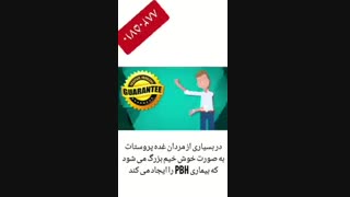 دانستنی های سرطان پروستات