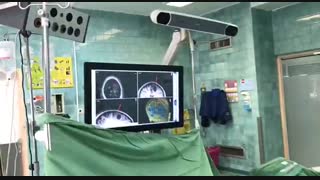 نمونه جراحی با سیستم Navigation