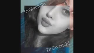 نمونه جراحی زیبایی بینی نیمه فانتزی