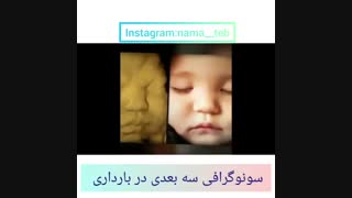 سونوگرافی سه بعدی در بارداری