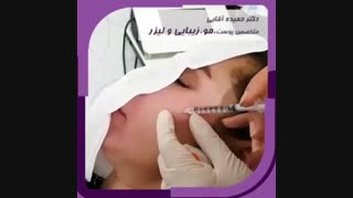 مزوتراپی صورت تزریق چربی