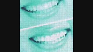 ونیر کامپوزیت چیست | پرسلن کامپوزیت چیست | مدت ماندگاری ونری کامپوزیت چقدر است | تفاوت لمینیت سرامیکی و لمینیت کامپوزیتی