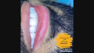 طریقه اصلاح طرح لبخند | مدت ماندگاری کامپوزیت دندان | قیمت روکش دندان| روکش زیرکونیا