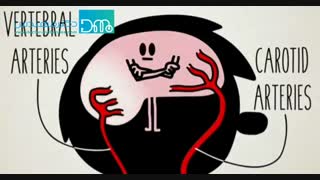 هنگام سکته مغزی چه کنیم