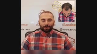 کاشت مو رنسانس - کلینیک تخصصی رنسانس کلینیک مو