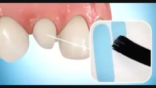 فیلم اصلاح شکل دندان