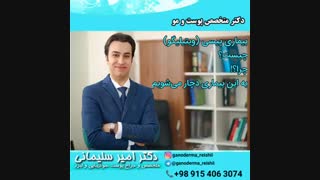 متخصص پوست:بیماری پیسی (ویتیلیگو) چیست؟!