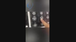 تومور بدخیم غده پاروتید