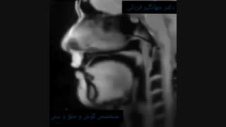 ام آر آی در حال صحبت