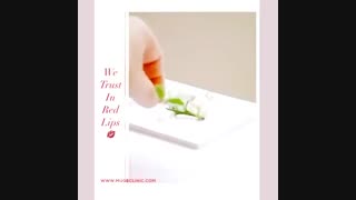 تزریق ژل لب