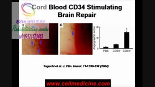 بهترین و مجهزترین مرکز توانبخشی البرز09121623463|رجایی شهر خیابان اشتراکی خیابان۱۰