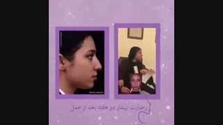 نمونه کار عمل زیبایی بینی