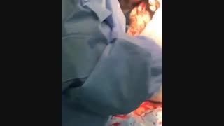 فیلم عمل سزارین