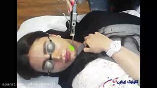 لیزر موهای زائد در کلینیک آریامن