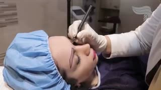 کاشت ابرو با طراحی ویژه شما