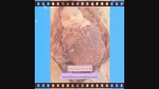 تولد فرشته ناز من بارلی به روش زایمان سزارین