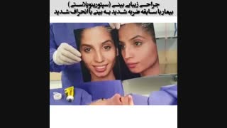 فیلم واقعی عمل زیبایی و انحراف بینی