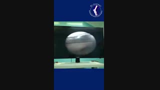 آرتروسکوپی زانو درمان پارگی مینیسک و آرتروز زانو