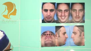 توضیحات دکتر سعید ظفرمند درباره جراحی بینی در اتاق عمل