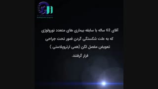 شکستگی گردن فمور تحت جراحی تعویض مفصل لگن