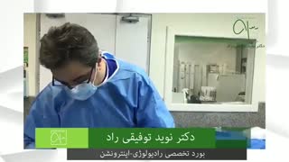 درمان واریس به روش RF
