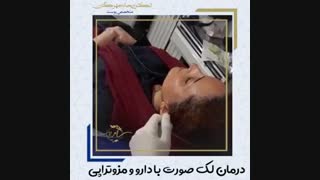 درمان لک صورت با داروی مزوتراپی مزوتراپی