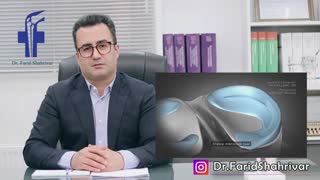 آرتروسکوپی زانو