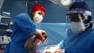 فیلم زایمان سزارین