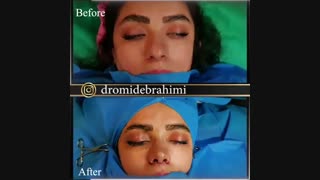 فیلم عمل بینی