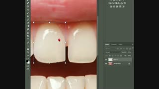 پر کردن فاصله بین دندان در فتوشاپ