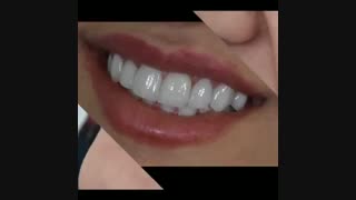لمینیت سرامیکی