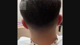 پروتز مو قسمتی از سر  09198858620