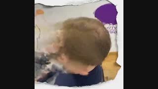 درمان  طاسی با الگوی مردانه 09198858620