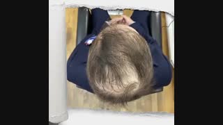 طاسی بالای سر  09198858620