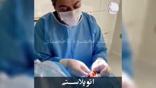 جراحـی اتوپلاستی بدون بیهوشی